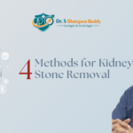 Methods for Kidney Stone Removal