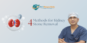 Say Goodbye to Pain: 4 Methods for Kidney Stone Removal